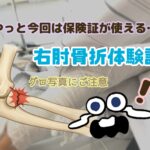 右肘骨折体験記
