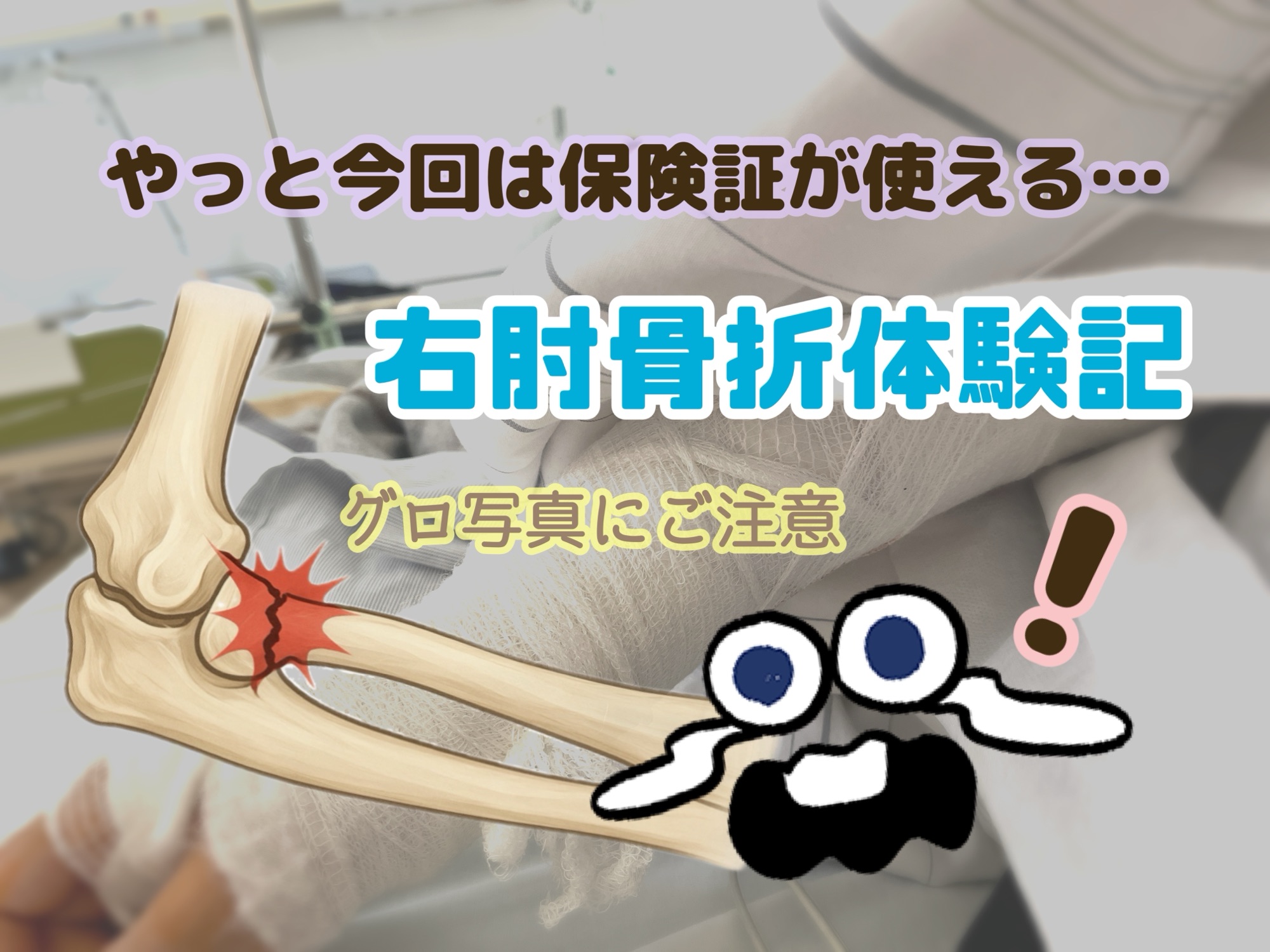 右肘骨折体験記